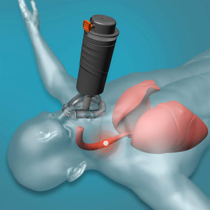 BabyAlert Dispositivo Automático Antiasfixia Alerta inmediata en casos de emergencia respiratoria